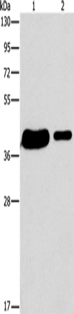 Anti-Human/Mouse/Rat SAE1 Antibody - ABMIUM