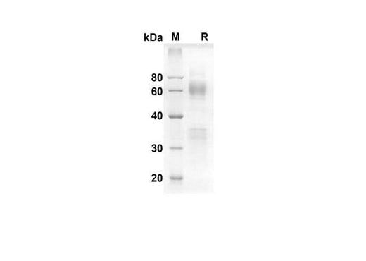 SDS-PAGE analysis of Mouse Clusterin proteins, 2 μg/lane of Recombinant Mouse Clusterin proteins was resolved with an SDS-PAGE under reducing conditions, showing bands at 71.8 kDa.