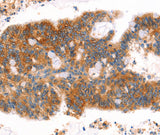 Anti-Human/Mouse/Rat AFDN Antibody - ABMIUM
