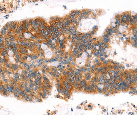 Anti-Human/Mouse/Rat AFDN Antibody - ABMIUM