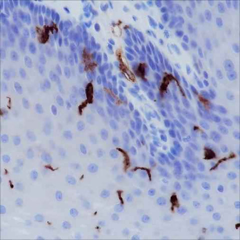 Anti-Human CD1a Antibody [A163] - ABMIUM
