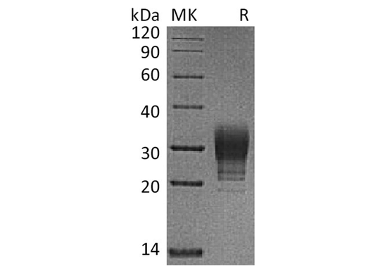 Recombinant Human CREG/CREG1 Protein (His Tag) - ABMIUM