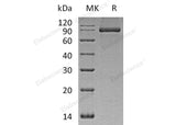 Recombinant Human PACSIN2/Syndapin-2 Protein (His Tag) - ABMIUM