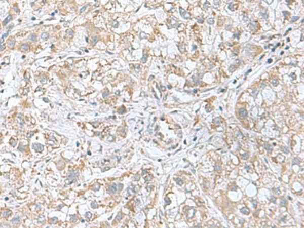 Anti-Human CGB5 Antibody