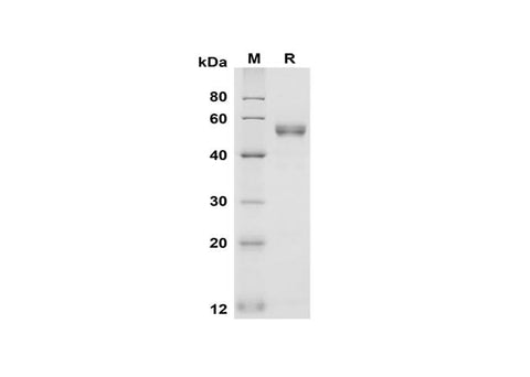 SDS-PAGE analysis of Human Fcγ RIIA/CD32a proteins, 2 μg/lane of Recombinant Human Fcγ RIIA/CD32a proteins was resolved with SDS-PAGE under reducing conditions, showing bands at 50 kDa.