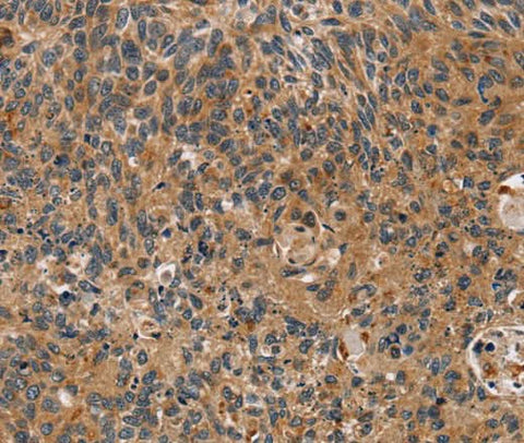 Anti-Human/Mouse/Rat TAC1 Antibody - ABMIUM
