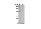 SDS-PAGE analysis of Human S100A7/PSOR1 proteins, 2 μg/lane of Recombinant Human S100A7/PSOR1 proteins was resolved with SDS-PAGE under reducing conditions, showing bands at 13 kDa.