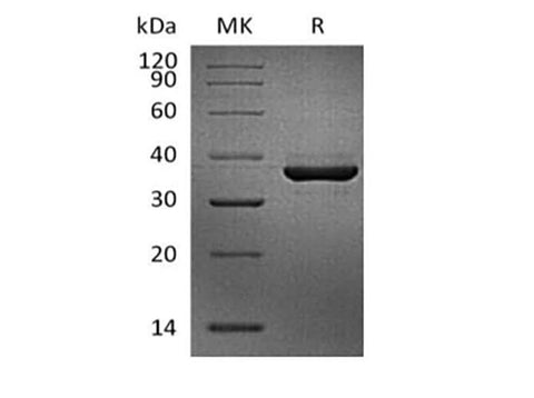 Recombinant Cynomolgus FGL1 (C-Avi-6His) Biotinylated - ABMIUM