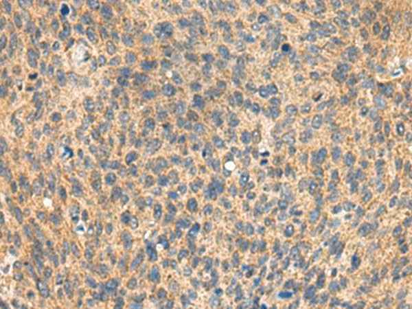 Anti-Human/Mouse/Rat MIA Antibody