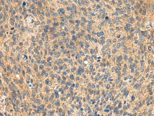 Anti-Human/Mouse/Rat MIA Antibody
