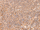 Immunohistochemistry of paraffin-embedded Human tonsil tissue using RABEPK Polyclonal Antibody at dilution of 1:85(×200)