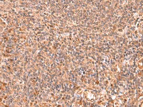 Anti-Human RABEPK Antibody