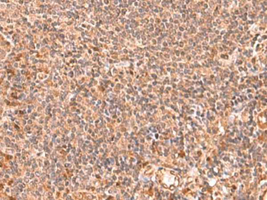 Anti-Human RABEPK Antibody