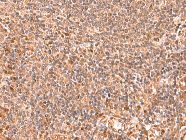 Immunohistochemistry of paraffin-embedded Human tonsil tissue using RABEPK Polyclonal Antibody at dilution of 1:85(×200)