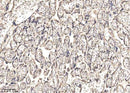 Anti-Human IGSF3 Antibody [A1064] - ABMIUM