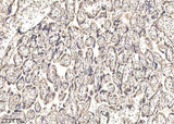 Anti-Human IGSF3 Antibody [A1064] - ABMIUM