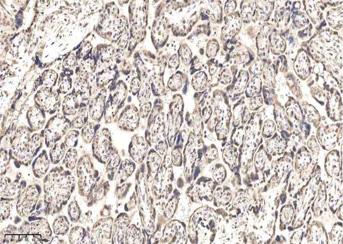 Anti-Human IGSF3 Antibody [A1064] - ABMIUM