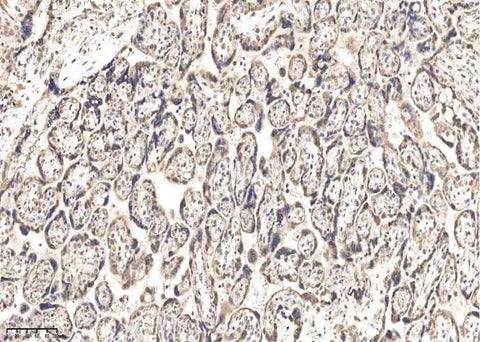 Anti-Human IGSF3 Antibody [A1064] - ABMIUM