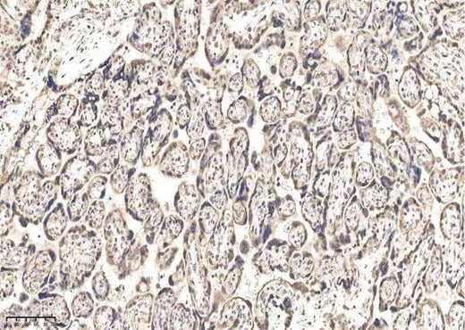 Anti-Human IGSF3 Antibody [A1064] - ABMIUM