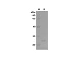 SDS-PAGE analysis of Mouse FGF21 proteins, 2 μg/lane of Recombinant Mouse FGF21 proteins, was resolved with SDS-PAGE under reducing conditions, showing bands at 24 kDa.