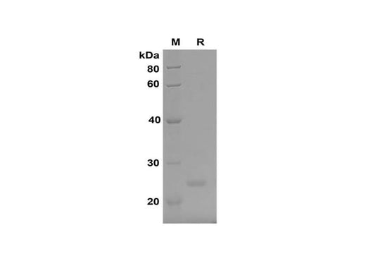 SDS-PAGE analysis of Mouse FGF21 proteins, 2 μg/lane of Recombinant Mouse FGF21 proteins, was resolved with SDS-PAGE under reducing conditions, showing bands at 24 kDa.