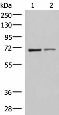 Western blot analysis of K562 and HepG2 cell lysates using EWSR1 Polyclonal Antibody at dilution of 1:1000