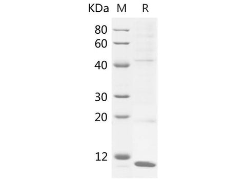 SDS-PAGE analysis of Mouse S100A1 proteins, 2 μg/lane of Recombinant Mouse S100A1 proteins was resolved with SDS-PAGE under reducing conditions, showing bands at 14 kDa.