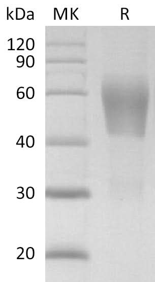 Recombinant SARS-CoV-2 S Protein RBD (C-mFc) V2 - ABMIUM