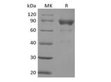 Recombinant Human SIRPB2 (C-Fc) - ABMIUM
