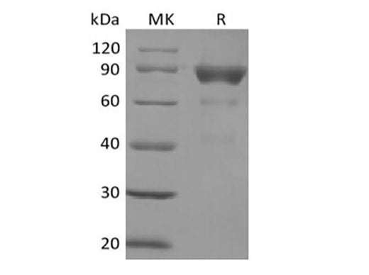 Recombinant Human SIRPB2 (C-Fc) - ABMIUM