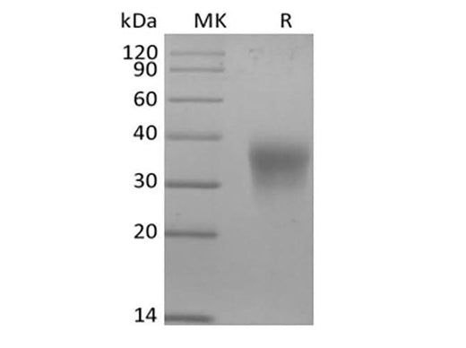 Recombinant Mouse Erythropoietin/EPO (C-6His) - ABMIUM