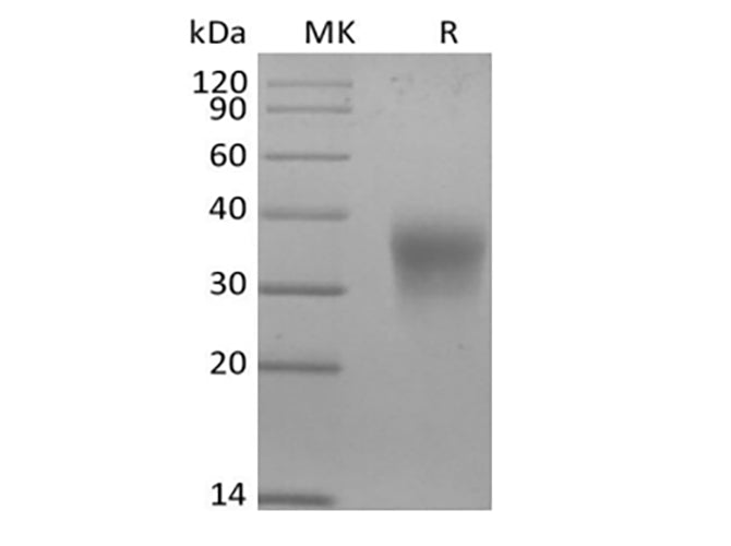 Recombinant Mouse Erythropoietin/EPO (C-6His) - ABMIUM