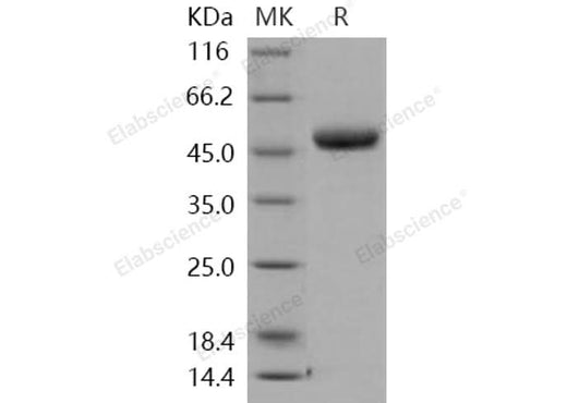 Recombinant Human Chitotriosidase/CHIT1 Protein (His Tag) - ABMIUM