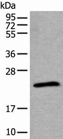 Anti-Human/Mouse/Rat TPT1 Antibody