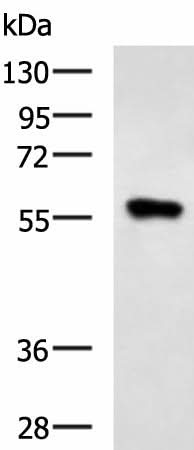 Western blot analysis of Raji cell lysate using SQSTM1 Polyclonal Antibody at dilution of 1:900