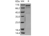 > 75 % as determined by reducing SDS-PAGE.
