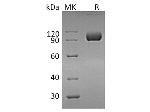 Recombinant Human EphA4 Protein (Fc Tag) - ABMIUM
