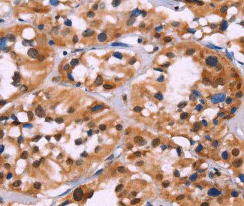 Anti-Human HIST1H1C Antibody
