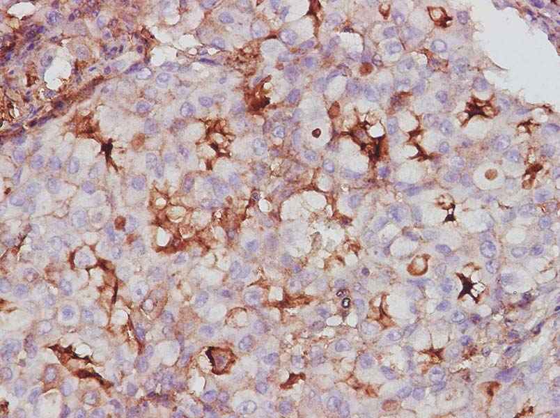 Anti-Human Endocan/ESM-1 Antibody - ABMIUM