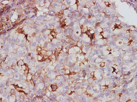 Anti-Human Endocan/ESM-1 Antibody - ABMIUM