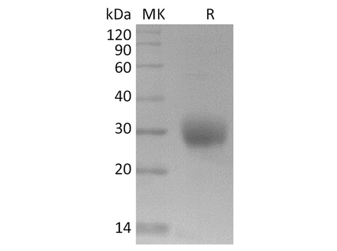 Recombinant SARS-CoV-2 Spike Protein (RBD, His Tag) - ABMIUM