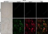 Control: Normal Hela cells were not treated with camptothecin. Camptothecin (10μM)-24h: Hela cells were treated with 10 μM camptothecin for 24h.