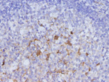 Anti-Human IDO1 Antibody - ABMIUM
