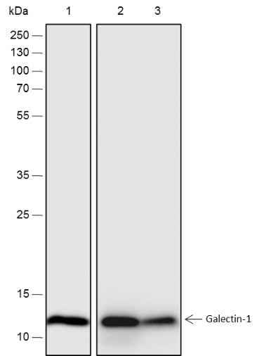 Anti-Human/Rat/Mouse Galectin-1 Antibody [A227]