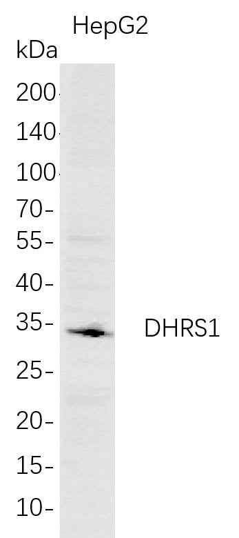 Anti-Human DHRS1 Antibody [B693]