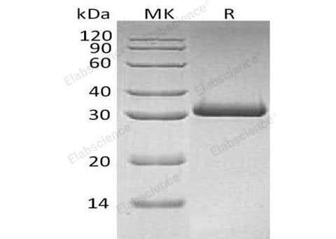 Recombinant Human MBL2/MBL/COLEC1 Protein (His Tag) - ABMIUM