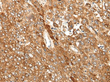 Anti-Human/Mouse CAD Antibody - ABMIUM