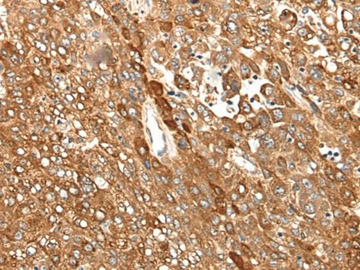 Anti-Human/Mouse CAD Antibody - ABMIUM