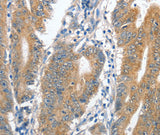 Anti-Human CENPC Antibody - ABMIUM
