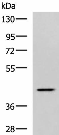 Western blot analysis of Hela cell lysate using SYT2 Polyclonal Antibody at dilution of 1:800